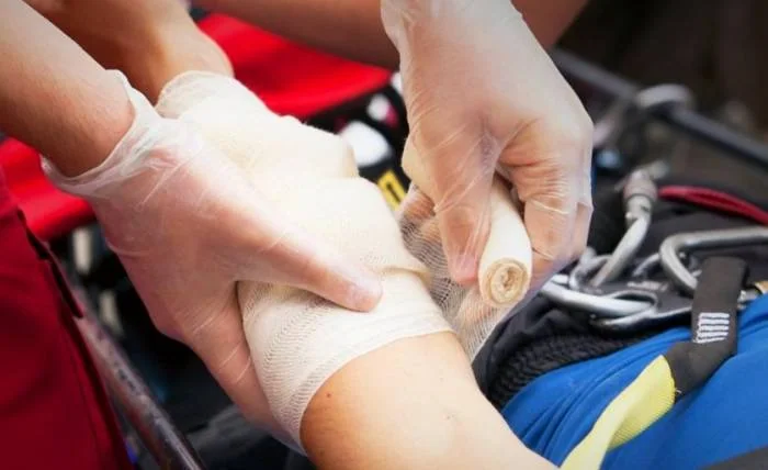 باندپیچی سوختگی در برق گرفتگی سوختگی در برق گرفتگی